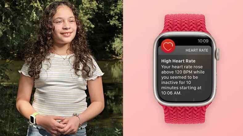  "Apple Watch" yenə həyat xilas edib: 12 yaşlı qızda xərçəng aşkarlanıb